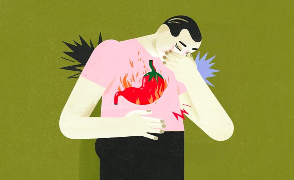 Your Guide to Tackling Holiday Heartburn